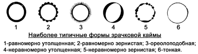 http://kunpendelek.ru/content/diagnostic/iridology/39.gif