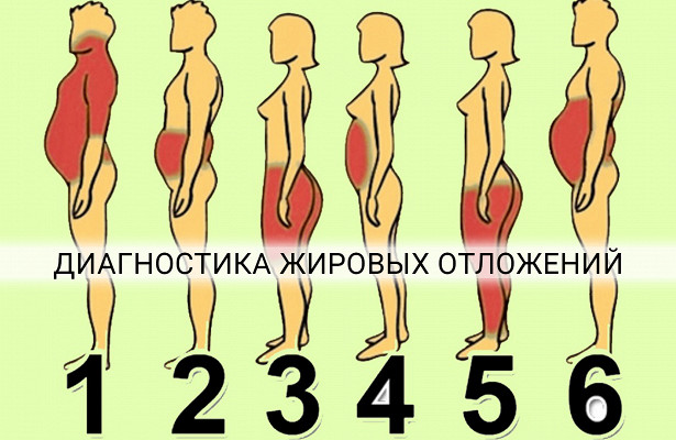 О чем говорят жировые отложения на разных частях тела