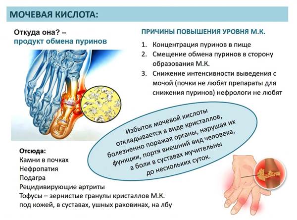 Мочевая кислота Мочевая кислота
