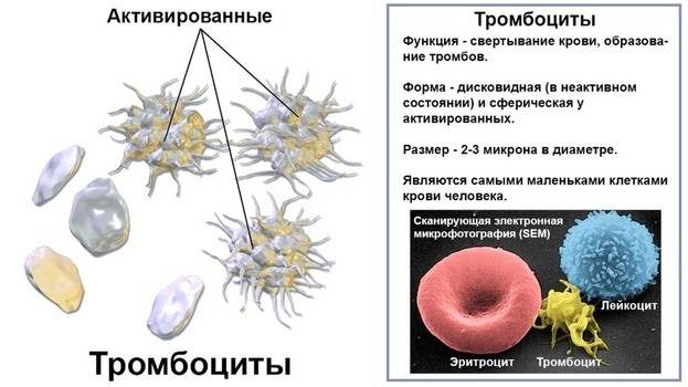 Почему тромбоциты в крови понижены, что это значит? Почему тромбоциты в крови понижены, что это значит?